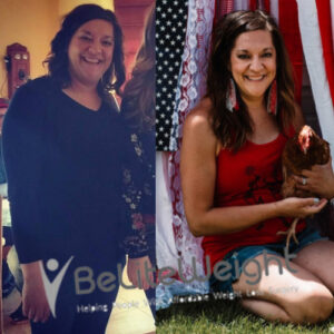 Monica S= Gastric Sleeve Before And After Pictures