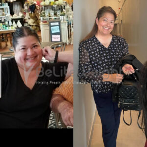 Raynee B= Gastric Sleeve Before And After