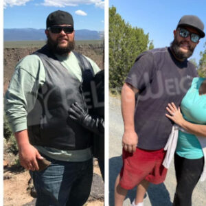 Gastric Sleeve Before And After Male