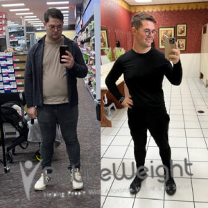 Seth W= Gastric Sleeve Before And After 6 Months