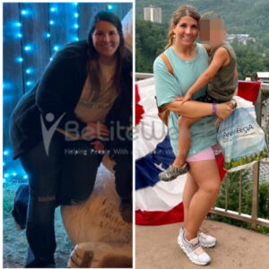 Sabrina K= Gastric Sleeve Surgery Before And After