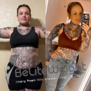 Brianna B= Gastric Sleeve Surgery Before And After
