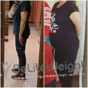 Tiffany B= Gastric Sleeve Before And After 6 Months