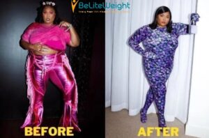 Toni Braxton - 'Embracing my WHOLE body...hysterectomy scars and all...