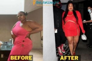 Lizzo Weight Loss Surgery: Diet, Photos & Workout Explained