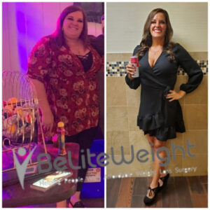 Brittany S= Before And After Gastric Bypass