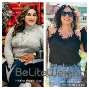 Gastric Bypass Surgery Before And After