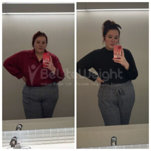 Jessica Y= Gastric Bypass Before and After