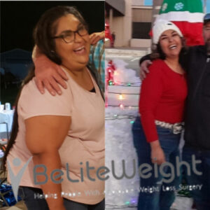 Michaela G= Gastric Bypass Surgery Before And After