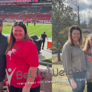 Michelle M= Before And After Gastric Bypass