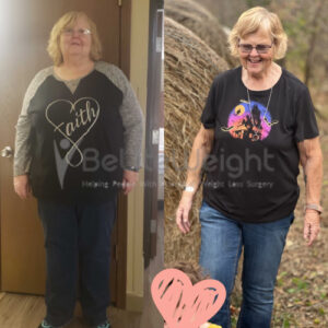 Ronnah B= Before And After Gastric Bypass Surgery