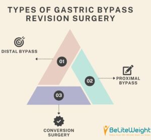 Types of Gastric Bypass Revision Surgery