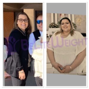 Gastric Bypass Revision Before And After
