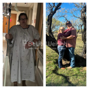 Vickie B= Gastric Bypass Before and After