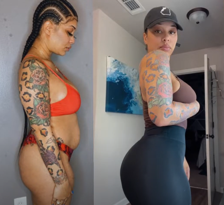 BBL After 10 Years An Inside Look At Long Term Butt Lift Results BBL After 10 Years An Inside Look At Long Term Butt Lift Results