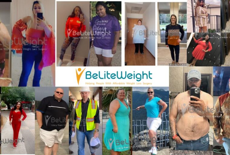 Gastric Sleeve Revision