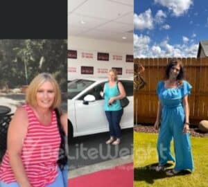 Bariatric Surgery - Altamirano M