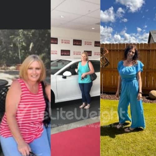 Bariatric Surgery - Altamirano M