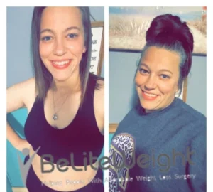 One Year Later: Living My Best Life - Gastric Sleeve Surgery