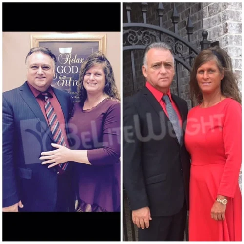 JUDITH AND JERRY Couples Weight Loss Surgery