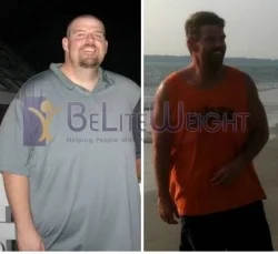 Weight Loss Surgery before and after Man - I have always been the "big" kid in class. I played 3 sports in high...