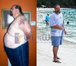Weight Loss Surgery before and after Patient - Whats up Joanne, I told you I would send you some Pics:-) I'm in the...