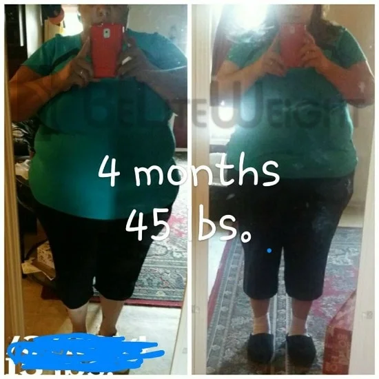 Weight Loss Surgery before and after Woman - Teresa sent this over and wanted to share her 45 pound weight loss in 4...