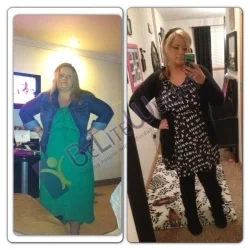 Weight Loss Surgery before and after Woman - Hello Ladies!I hope you are both doing well and had a lovely Thanksgiving! I wanted...