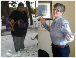 Weight Loss Surgery before and after Patient - Ishi,It was great talking to after 3 years. Here are the before and after pictures...