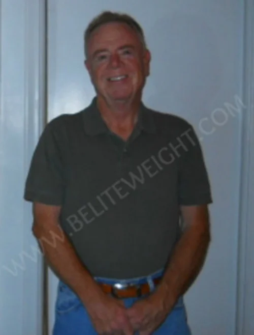 Mini Gastric Bypass Surgery In Mexico