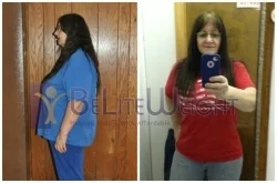 Weight Loss Surgery before and after Patient - I just want to tell you how happy I am with my new body. Dr....