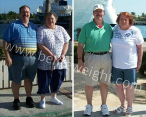 Gastric Sleeve Before and After Photos - Almost Divorced over Weight Loss Surgery | beliteweight.com