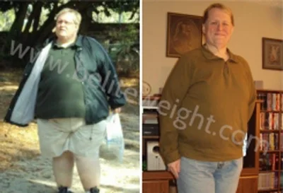 Gastric Sleeve Before and After Photos - Stephen\\\\\\\'s Story | beliteweight.com