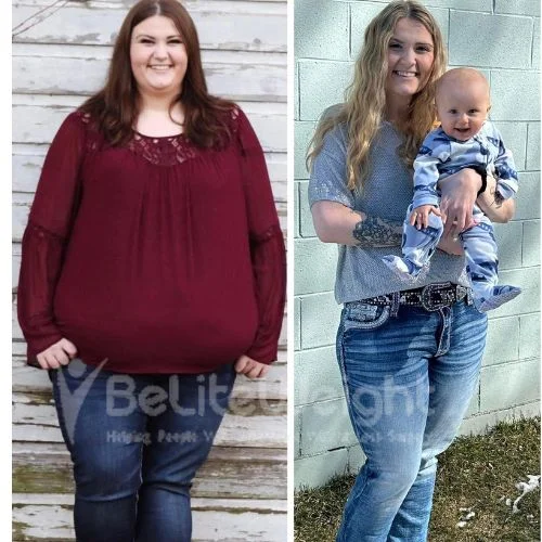 Alyssa L - bypass revision update after 2 years*