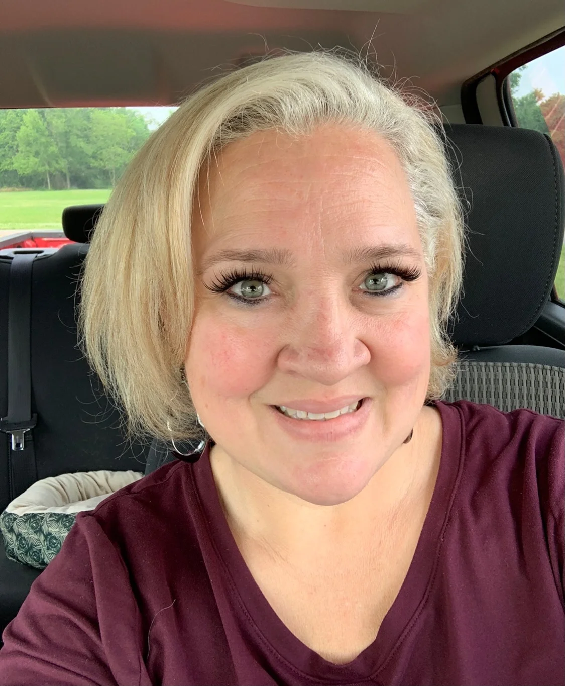 Weight Loss with Gastric Sleeve Surgery