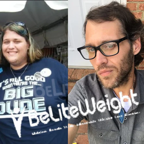 Gastric Sleeve before and after Patient - Howdy BeLiteWeight team!!!! 3 years out and holding steady at 180-190lbs. Starting to save for...
