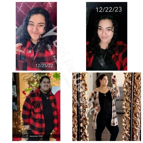 Gastric Sleeve before and after Patient - My journey has been amazing. Yes one whole year and I've lost 197 pounds! I...