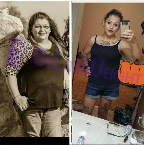 Weight Loss Surgery before and after Patient -  I'm doing great and down 115 lbs. Surgeons Dr. Jose Rodriguez and Elmo AramburoProcedure Gastric Sleeve *See...