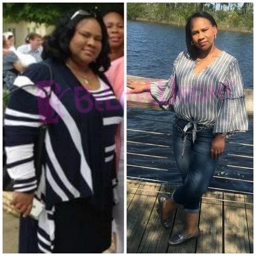Weight Loss Surgery before and after Patient - "I feel good,  I have energy to walk, run, climb, dance, bend and swim.  I...
