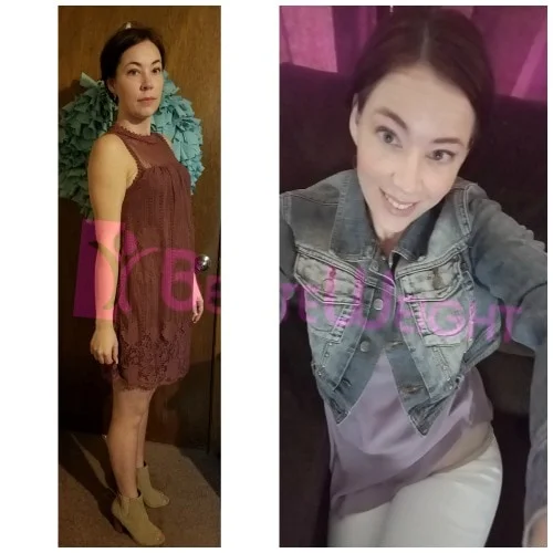 Weight Loss Surgery before and after Patient - Still so happy with the surgerySurgeons Dr. Jose Rodriguez and Elmo AramburoProcedure Gastric Bypass *See Below 