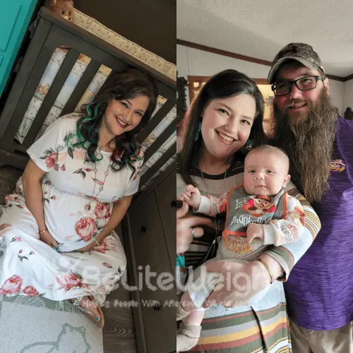 Victoria .B RNY gastric bypass 2  years update *