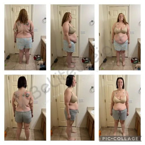 Duodenal Switch before and after Patient - The photos are 1 year apart. 305lbs to 210lbs. I'm able to play with my...