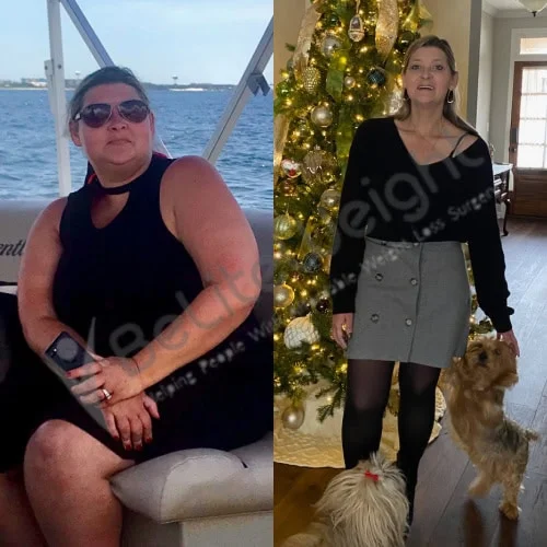 Gastric Sleeve before and after Patient - My before and  my most recent photo. I am feeling great, and around 120 pounds...