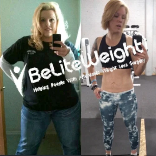 Gastric Sleeve before and after Man - First I want to say thank you! Without BeLiteWeight I wouldn't be the woman I...