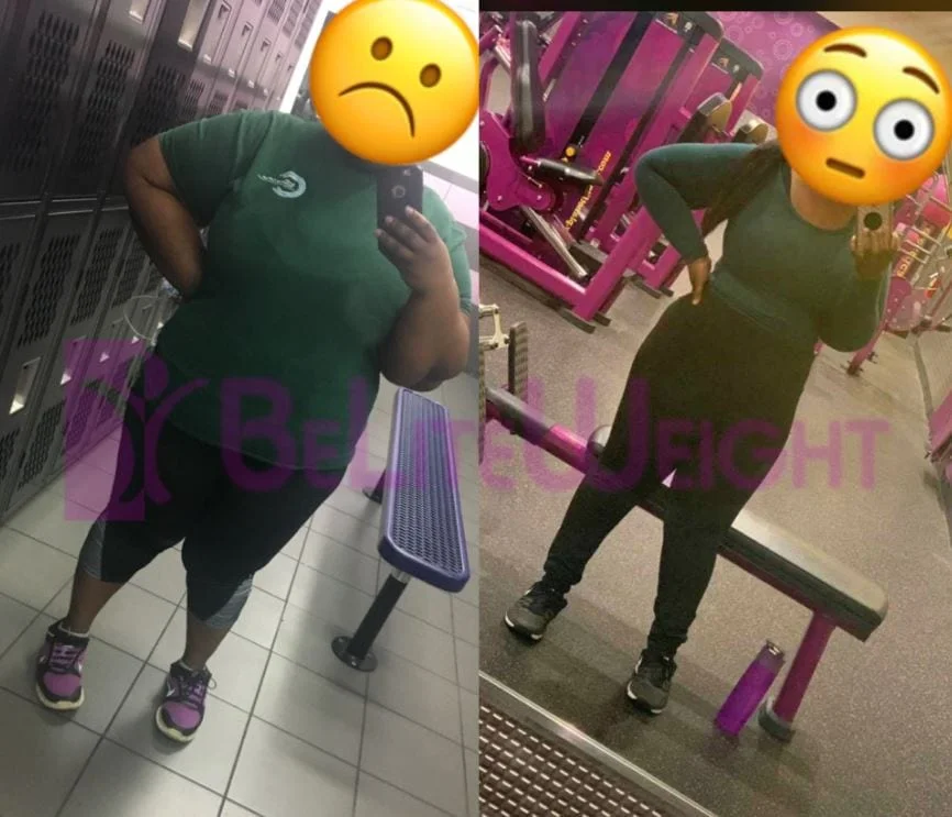 Weight Loss Surgery before and after Patient - I really had to send my biggest thank you to you and everyone at Beliteweight...