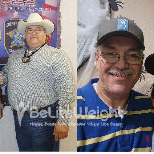 Eddie M - gastric bypass Update after 2 years*