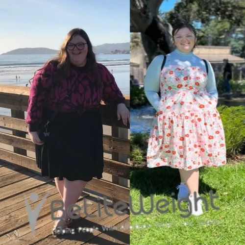 Weight Loss Surgery Before And After
