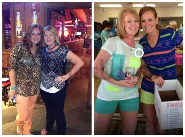 Danielle - After Gastric Sleeve Surgery with Dr. Elmo Aramburo