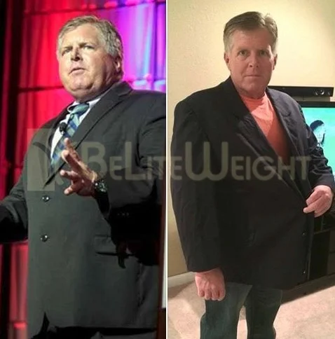 Weight Loss Surgery before and after Man - A New Year email we received this morning from Kirk and he gave us permission...