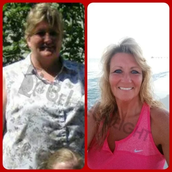 Weight Loss Surgery before and after Patient - Hello JoAnne I came about this old picture at my highest weight and the latest...the...